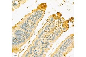 Immunohistochemistry (Paraffin-embedded Sections) (IHC (p)) image for anti-Solute Carrier Family 6 (Neutral Amino Acid Transporter), Member 19 (SLC6A19) antibody (ABIN7075682)