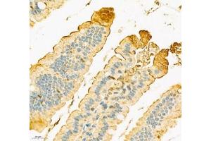 Immunohistochemistry of paraffin embedded mouse duodenum using SLC6A19 (ABIN7075682) at dilution of 1:900 (400x lens) (SLC6A19 抗体)