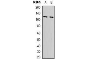 Western blot analysis of RPS6KC1 expression in Hela (A), HEK293T (B) whole cell lysates. (RPS6KC1 抗体)