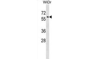 Western Blotting (WB) image for anti-Sorting Nexin 18 (SNX18) antibody (ABIN2999384) (SNX18 抗体)