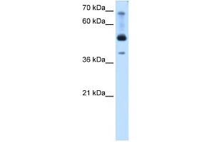 Western Blotting (WB) image for anti-Transcription Factor AP-2 beta (Activating Enhancer Binding Protein 2 Beta) (TFAP2B) (N-Term) antibody (ABIN2780495)