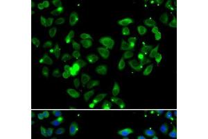 Immunofluorescence analysis of A549 cells using CARD11 Polyclonal Antibody (CARD11 抗体)