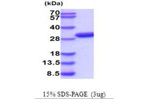 SDS-PAGE (SDS) image for phosphoribosyl Pyrophosphate Synthetase 2 (PRPS2) (AA 1-321) protein (His tag) (ABIN5854265)