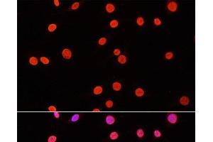 Immunofluorescence analysis of C6 cells using DiMethyl-DNMT3A-K44 Polyclonal Antibody at dilution of 1:100. (DNMT3A 抗体  (2meLys44))