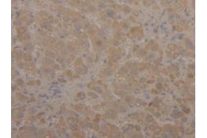 DAB staining on IHC-P; Samples: Human Liver Tissue (ALDH2 抗体  (AA 59-150))