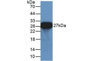 Detection of Recombinant GFP using Polyclonal Antibody to Green Fluorescent Protein (GFP) (GFP 抗体  (AA 1-238))