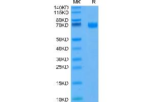 CD19 Protein (AA 20-291) (His tag,FITC)