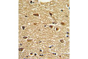 Formalin-fixed and paraffin-embedded human brain tissue reacted with ETV4 Antibody (C-term), which was peroxidase-conjugated to the secondary antibody, followed by DAB staining. (ETV4 抗体  (C-Term))