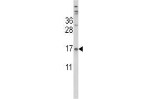 Western Blotting (WB) image for anti-Transthyretin (TTR) antibody (ABIN3002756) (TTR 抗体)