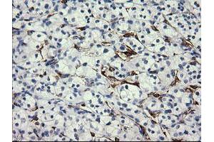 Image no. 1 for anti-Fetal and Adult Testis Expressed 1 (FATE1) antibody (ABIN1498223) (FATE1 抗体)