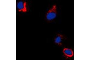 Immunofluorescent analysis of EPHB1/2 (pY594/604) staining in A431 cells. (EPHB1/2 抗体  (pTyr594, pTyr604))