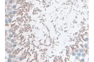 Immunohistochemistry (IHC) image for anti-Glutathione S-Transferase mu 4 (GSTM4) (AA 21-215) antibody (ABIN7444301)