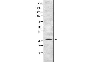 Western blot analysis of FGFP1 expression in HEK293 cells ,The lane on the left is treated with the antigen-specific peptide. (FGFBP1 抗体  (C-Term))
