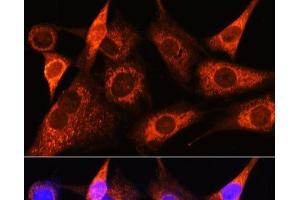 Immunofluorescence analysis of NIH-3T3 cells using PSAT1 Polyclonal Antibody at dilution of 1:100 (40x lens). (PSAT1 抗体)