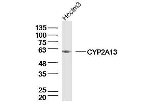 Hcclm3 lysates probed with CYP2A13 Polyclonal Antibody, Unconjugated  at 1:300 dilution and 4˚C overnight incubation. (CYP2A13 抗体  (AA 301-400))