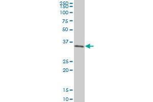 SIX3 monoclonal antibody (M01), clone 3D12 Western Blot analysis of SIX3 expression in 293 . (SIX3 抗体  (AA 273-332))