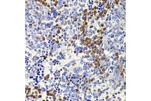 Immunohistochemistry of paraffin-embedded rat spleen using IL21 antibody. (IL-21 抗体  (AA 25-162))