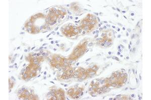 Immunohistochemistry (IHC) image for anti-Programmed Cell Death 6 Interacting Protein (PDCD6IP) (AA 818-868) antibody (ABIN7453859)