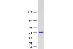 Western Blotting (WB) image for Family with Sequence Similarity 9, Member B (FAM9B) protein (Myc-DYKDDDDK Tag) (ABIN2720832)