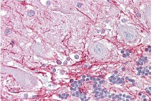 Immunohistochemistry with Brain, cerebellum tissue at an antibody concentration of 5µg/ml using anti-RP2 antibody (ARP56724_P050) (RP2 抗体  (Middle Region))