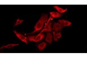 ABIN6276223 staining HepG2 by IF/ICC. (TAS2R39 抗体  (Internal Region))