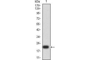 Western blot analysis using SP17 mAb against human SP17 (AA: 1-152) recombinant protein. (SPA17 抗体  (AA 1-152))