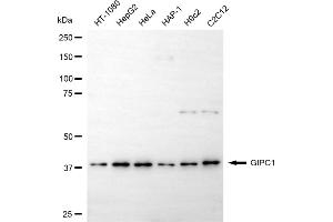 Western blotting analysis using GIPC1 antibody (ABIN7798719).