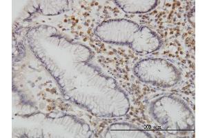Immunostaining (ISt) image for anti-Calcium/calmodulin-Dependent Protein Kinase Kinase 1, alpha (CAMKK1) (AA 1-520) antibody (ABIN566554)