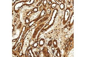 IHC analysis of SELENBP1 using anti-SELENBP1 antibody (ABIN7600755). (SELENBP1 抗体  (AA 23-462))