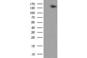 Western Blotting (WB) image for anti-ATP/GTP Binding Protein 1 (AGTPBP1) (AA 368-753) antibody (ABIN1491459) (AGTPBP1 抗体  (AA 368-753))