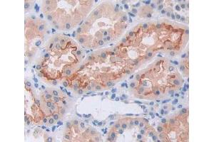 Used in DAB staining on fromalin fixed paraffin- embedded Kidney tissue (GRIK2 抗体  (AA 286-561))