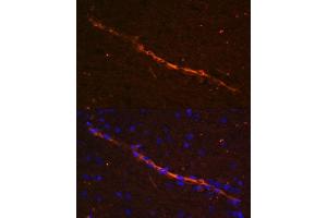 Immunofluorescence analysis of rat brain using CD34 antibody (ABIN6134661, ABIN6138169, ABIN6138171 and ABIN6218103) at dilution of 1:100. (CD34 抗体  (C-Term))