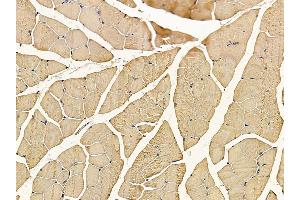 ABIN6257403 and ABIN6276254 at 1/100 staining mouse muscle tissue by IHC-P.