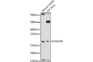 Western blot analysis of extracts of various cell lines, using CLEC4D Rabbit pAb (ABIN3016482, ABIN3016483, ABIN3016484 and ABIN6219759) at 1:1000 dilution.