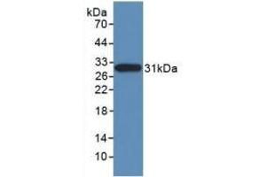 Detection of Recombinant NES, Human using Monoclonal Antibody to Nestin (NES) (Nestin 抗体  (AA 178-399))