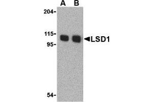 Western Blotting (WB) image for anti-Lysine (K)-Specific Demethylase 1A (KDM1A) (N-Term) antibody (ABIN1031442) (LSD1 抗体  (N-Term))