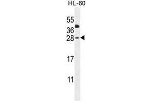 CLEC2A Antibody (Center) western blot analysis in HL-60 cell line lysates (35µg/lane). (CLEC2A 抗体  (Middle Region))