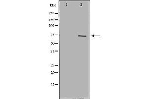 Western blot analysis of extracts of Sw626 ,using FSHR antibody. (FSHR 抗体  (Internal Region))
