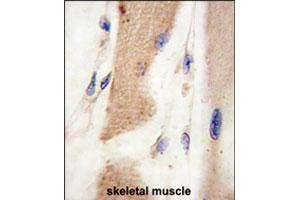 Formalin-fixed and paraffin-embedded human skeletal muscle tissue reacted with CDH15 polyclonal antibody  , which was peroxidase-conjugated to the secondary antibody, followed by DAB staining. (CDH15 抗体  (C-Term))