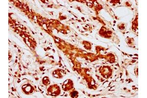 Immunohistochemistry (IHC) image for anti-MOB1, Mps One Binder Kinase Activator-Like 1B (MOBKL1B) (AA 2-216) antibody (ABIN7160116)