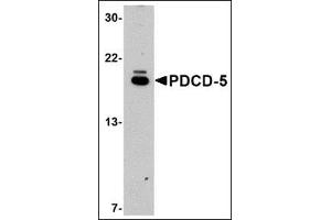 Western blot analysis of PDCD5 in EL4 cell lysate with this product at 1μg/ml.