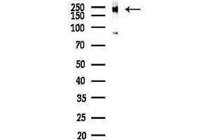 anti-Mediator Complex Subunit 1 (MED1) (pThr1457) antibody