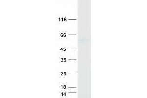 Western Blotting (WB) image for Bardet-Biedl Syndrome 4 (BBS4) protein (Myc-DYKDDDDK Tag) (ABIN2715167)