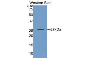 Western blot analysis of the recombinant protein. (PML 抗体  (AA 59-239))