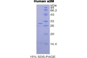 SDS-PAGE (SDS) image for alpha-2-Macroglobulin (A2M) ELISA Kit (ABIN6574245)