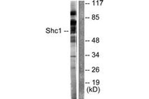 Western blot analysis of extracts from HeLa cells, treated with Calyculin A 50nM 15', using Shc (Ab-349) Antibody. (SHC1 抗体  (AA 315-364))