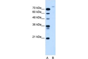 Western Blotting (WB) image for anti-Ubiquitin Specific Peptidase 48 (USP48) antibody (ABIN2463984) (USP48 抗体)