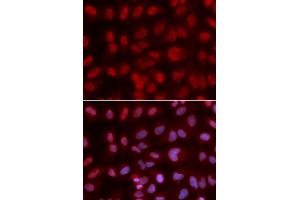 Immunofluorescence analysis of U2OS cells using SIN3A antibody. (SIN3A 抗体)