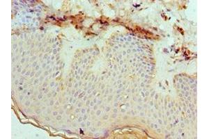 Immunohistochemistry of paraffin-embedded human skin tissue using ABIN7151879 at dilution of 1:100 (Ephrin B2 抗体  (AA 28-229))