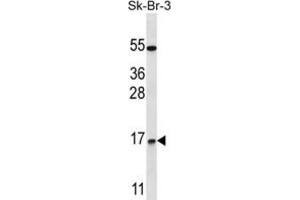 Western Blotting (WB) image for anti-NOTCH-Regulated Ankyrin Repeat Protein (NRARP) antibody (ABIN2997445)